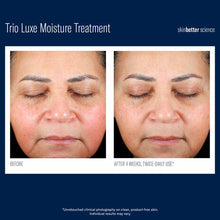 Load image into Gallery viewer, SkinBetter Trio Luxe