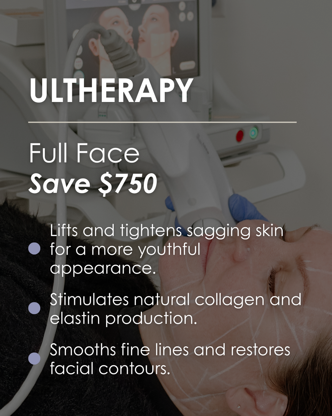Ultherapy Full Face - SAVE $750