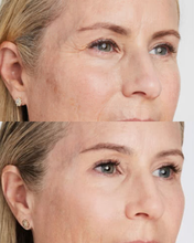 Load image into Gallery viewer, Ultherapy Full Face - SAVE $750
