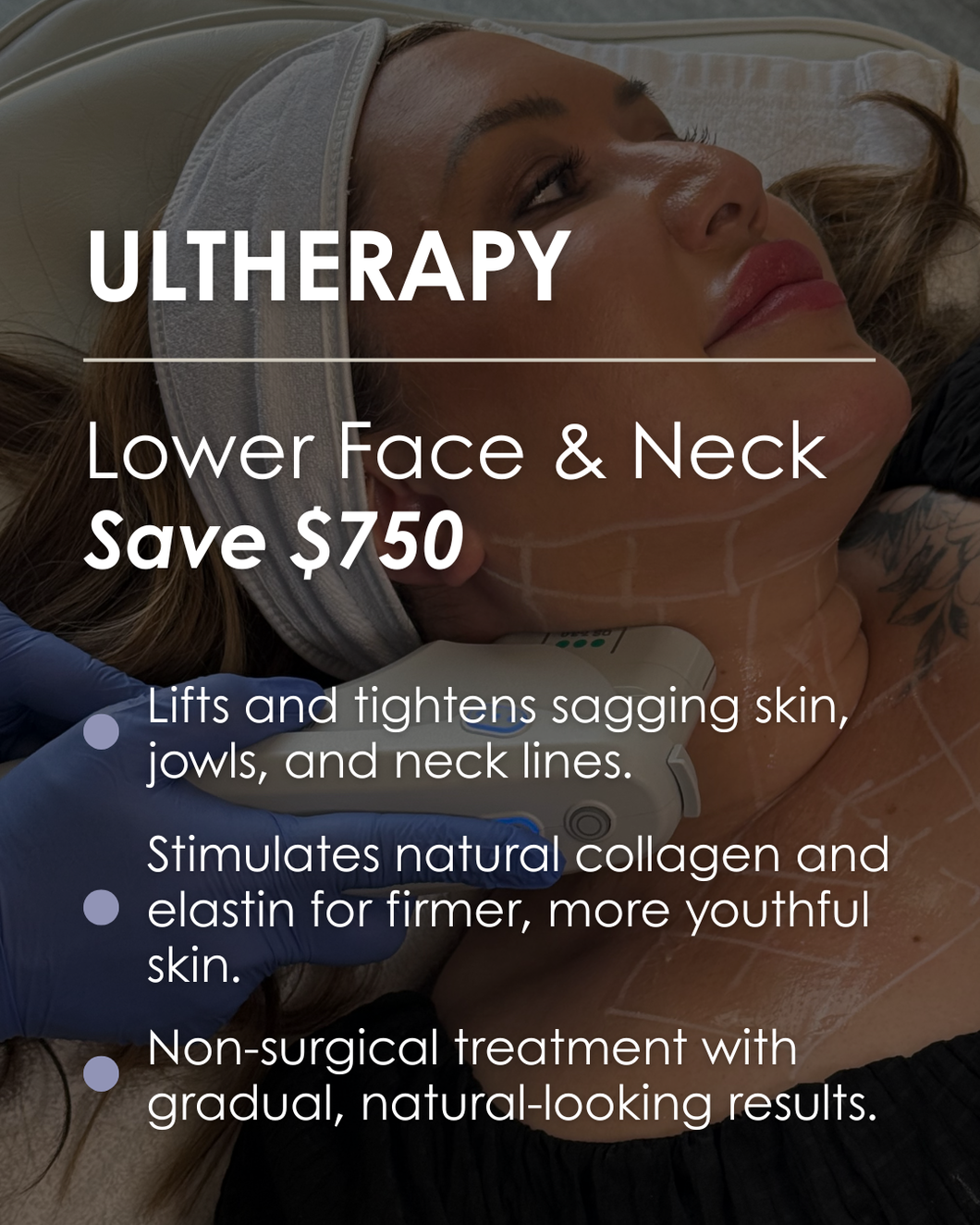 Ultherapy Lower Face & Neck - Save $750