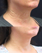 Load image into Gallery viewer, Exosomes - Save $126
