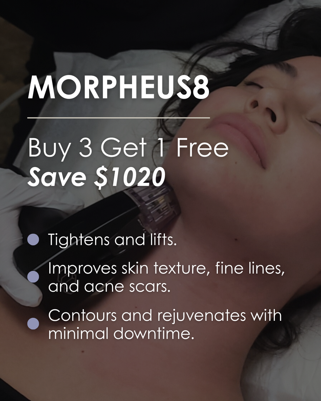 Morpheus8 - Buy 3 Get 1 FREE