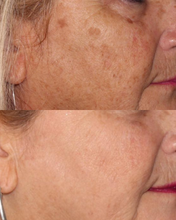 Load image into Gallery viewer, IPL - Buy 3, Get 1 FREE
