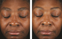 Load image into Gallery viewer, Skinbetter Science Mystro Revive Renewing Serum
