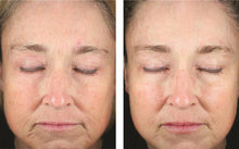 Load image into Gallery viewer, Skinbetter Science Mystro Revive Renewing Serum
