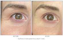 Load image into Gallery viewer, Hydrinity Eye Renew Complex
