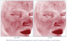 Load image into Gallery viewer, Hydrinity PRELUDE Facial Treatment Cleanser
