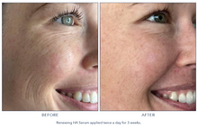 Load image into Gallery viewer, Hydrinity Renewing HA Serum
